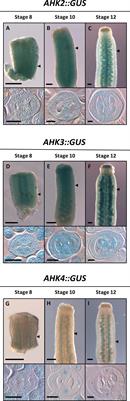 Redundant and Non-redundant Functions of the AHK Cytokinin Receptors During Gynoecium Development